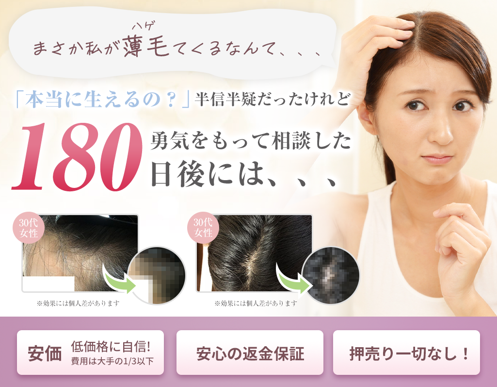滋賀県で薄毛の改善を目指す薄毛専門サロン